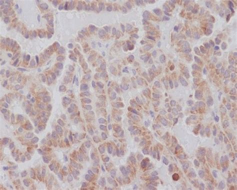 KIFC1 Rabbit MAb SAB Signalway Antibody