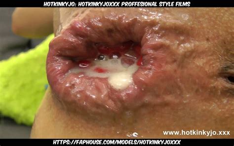 Dong Blanca En El Culo Y Prolapso Anal Por Hotkinkyjo XHamster