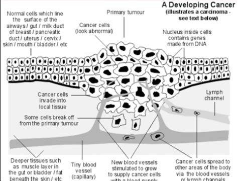 Cancers Flashcards Quizlet