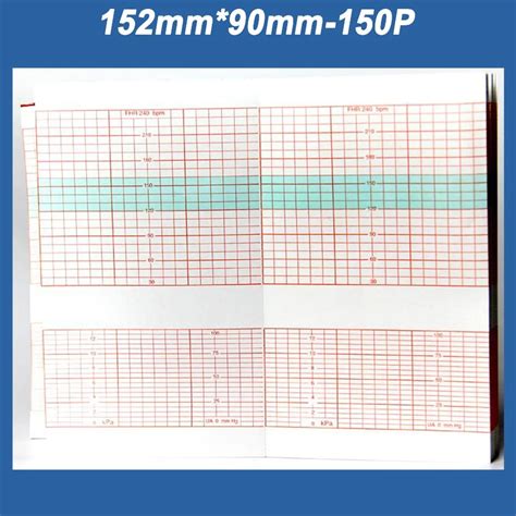 Papel de monitor fetal Edan F2 F3 F6 F9 GE170 152 90 150 papel gráfico