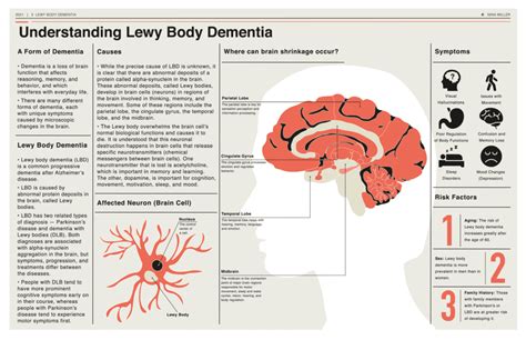 Lewy Body Dementia Parkinson S Dementia Penn Memory Center