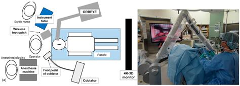 Medicina Free Full Text Improvement Of Surgical View And Working