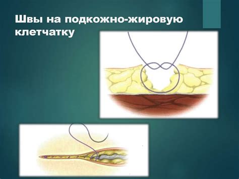 Кожный шов и основы пластической хирургии - презентация онлайн