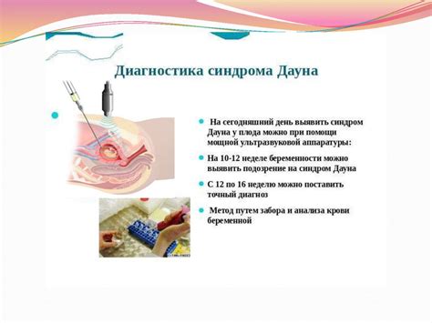 Синдром Дауна - презентация онлайн