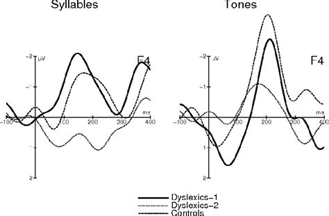 Figure 1 From Psychophysical And Neurophysiological Approaches To