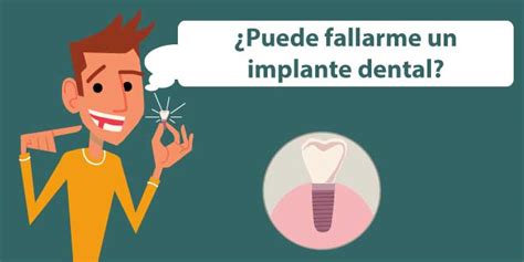 Guía de las complicaciones de los Implantes Dentales