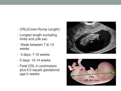 Determination Of Gestational Age Revised Copy