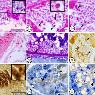 The Initial Stage Of Ovarian Follicular Atresia A Shrinkage And