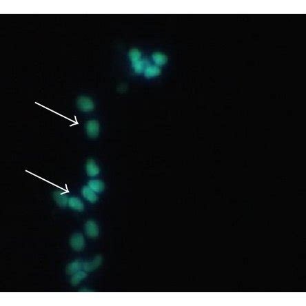 Effect of treatments on morphology of differentiated SH-SY5Y cells. (a ...