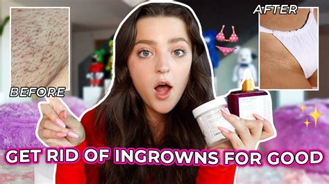 The Truth About Treating Ingrowns Best Bikini Line Shave Routine To Make Them Go Away For Good