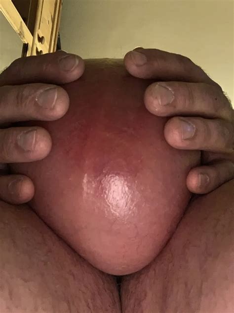 Glucose Prozent Liter Nude Pics Xhamster