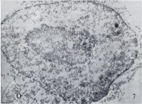 The Ultrastructure Of The Nuclear Envelope As Seen In Replicas From Normal And Neoplastic Nuclei