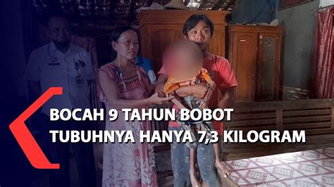 Bocah 9 Tahun Di Blora Bobot Tubuhnya Hanya 7 3 Kilogram YouTube