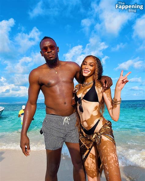 Winnie Harlow Winnieharlow Nude Leaks Photo TheFappening