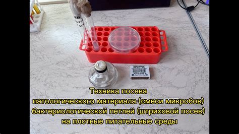 Техника посева смеси микробов на плотные питательные среды ...