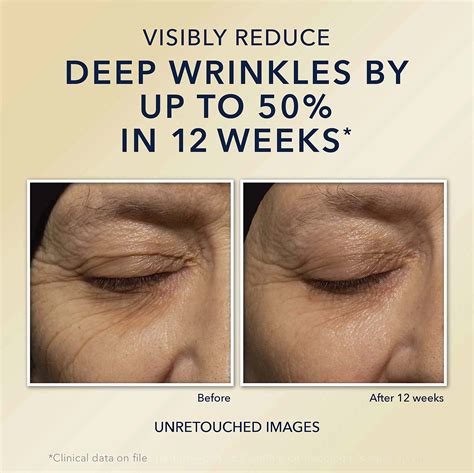 Ro C Retinol Correxion Deep Wrinkle Anti Aging Night Cream Desertcart
