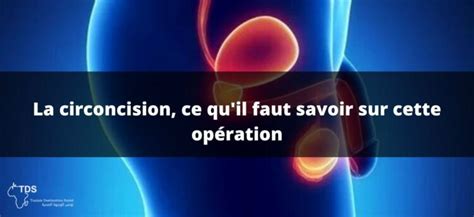 Circoncision tout savoir sur l opération et ses effets sur la santé