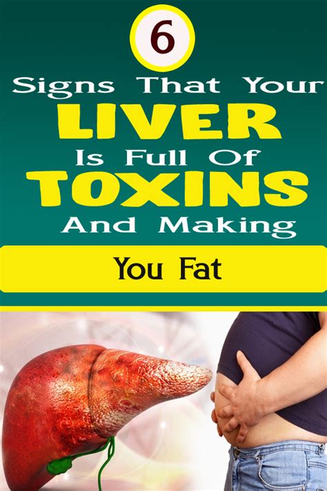 6 Signs That Your Liver Is Full Of Toxins And Making You Fat