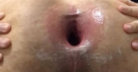 Ass Gaped By Huge Black Dildo Colombian Gay Amateur Amateur Porn Xhamster