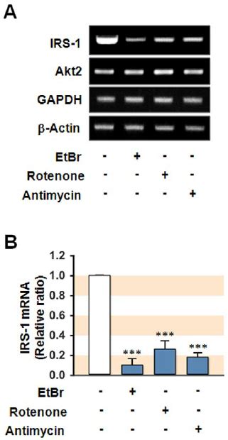 Transcriptional Inhibition Of Irs 1 In Hepatocytes With Dysfunctional