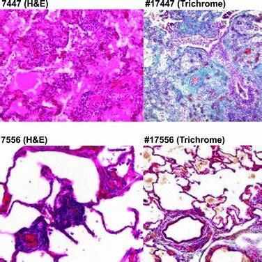 Graft histology. (A) Animal #17447 (recipient of lung from a brain dead ...