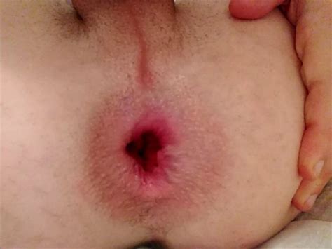 Le Gros Plug Anal En Verre D Erika Oak Et Son Clito D Goulinant En Cage Xhamster