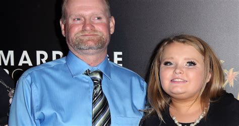 Honey Boo Boos Dad 50 Uses Cancer Scare For Major Dental Makeover