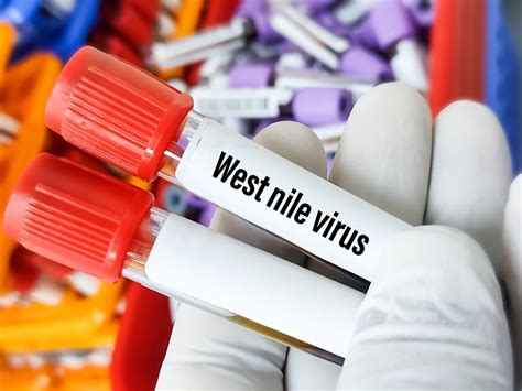 West Nile Virus: Causes, Symptoms, Diagnosis, Treatment