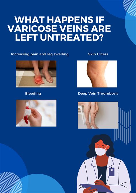 Dangers Of Varicose Veins Left Untreated Vein Clini