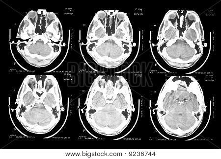 Ct Scan Brain Stock Photo & Stock Images | Bigstock