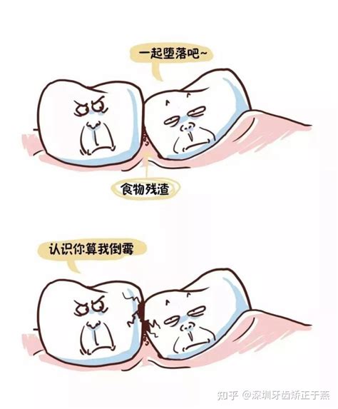 智齿不疼可以不拔吗？ 知乎