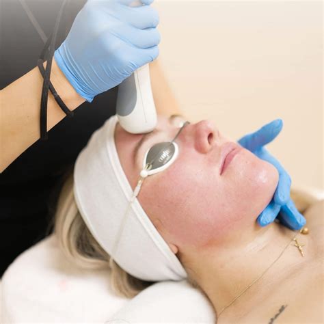 Intense Pulsed Light Therapy | Renue Medical Spa