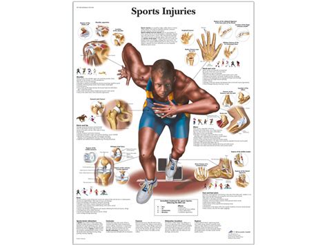 anatomical chart sports injuries   medical integration