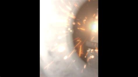 Endoscope Camera Anal Inspection Preview Pornhub