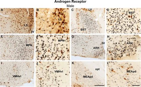 Frontiers Sex Differences In The Coexpression Of Prokineticin