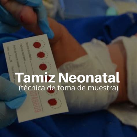 Tamiz Neonatal