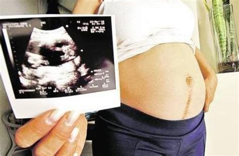 Le Prest El Vientre A Su Hijo Gay Para Que Sea Pap