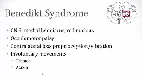 Benedikt Syndrome