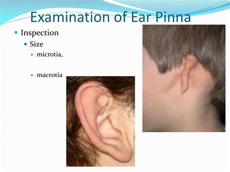 PPT Introduction To ENT History And Clinical Examination PowerPoint