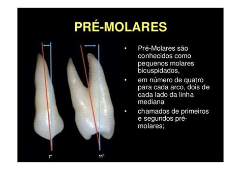 Premolares Superiores