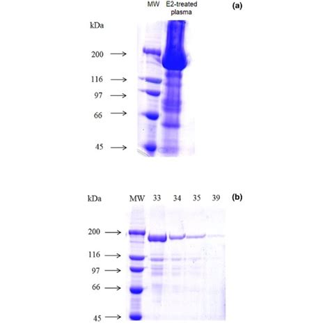 A Sds Page Electrophoretic Profile Showing Protein Composition Of