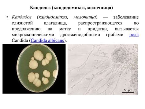 Кандида Кандидоз – Telegraph