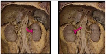 Pelvis 1 Urinary System Fasciae Muscles DPT Anatomy 2 Exam 2