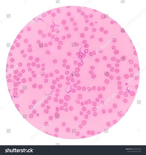 Trypanosoma Sp Among Red Blood Cells Stock Photo Shutterstock