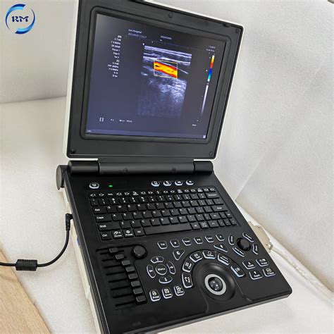 Medical Professional Hospital 2D/3D Color Doppler Ultrasound for Human ...