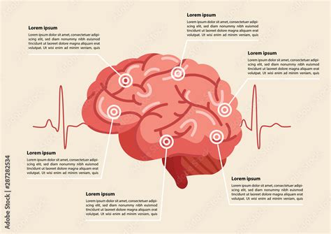 Human Brain Stroke Illustration Stock Vector Adobe Stock
