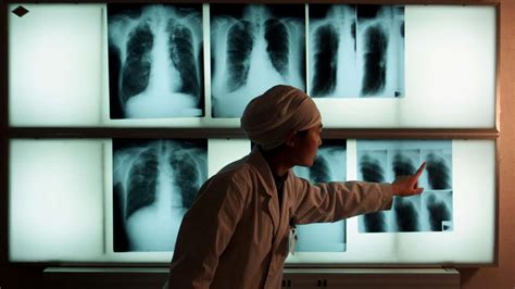 What exactly is a disease? 