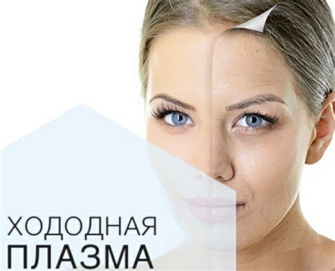 Холодная плазма - «Красота без уколов - возможна! » | отзывы