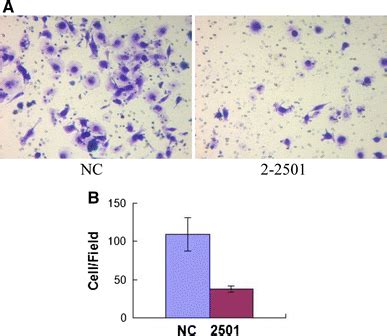 Knockdown Of Notch2 Inhibits Cell Invasion Of SACC 83 Cells Invasion