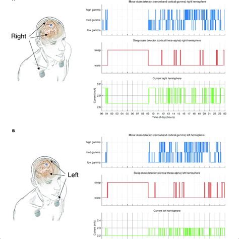 Patient 19—finger-nose test—right hand: The signal before (blue) and ...